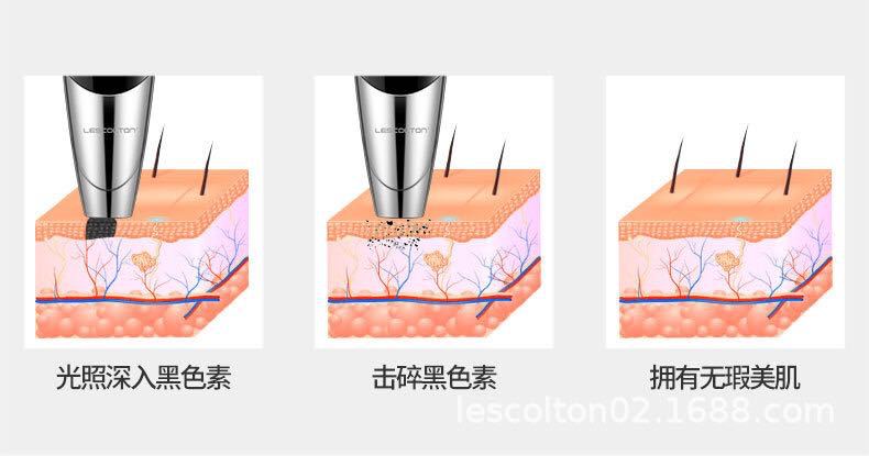 便携式激光皮秒仪点痣笔祛斑笔去纹身祛痘印却黑色素美容仪器家用