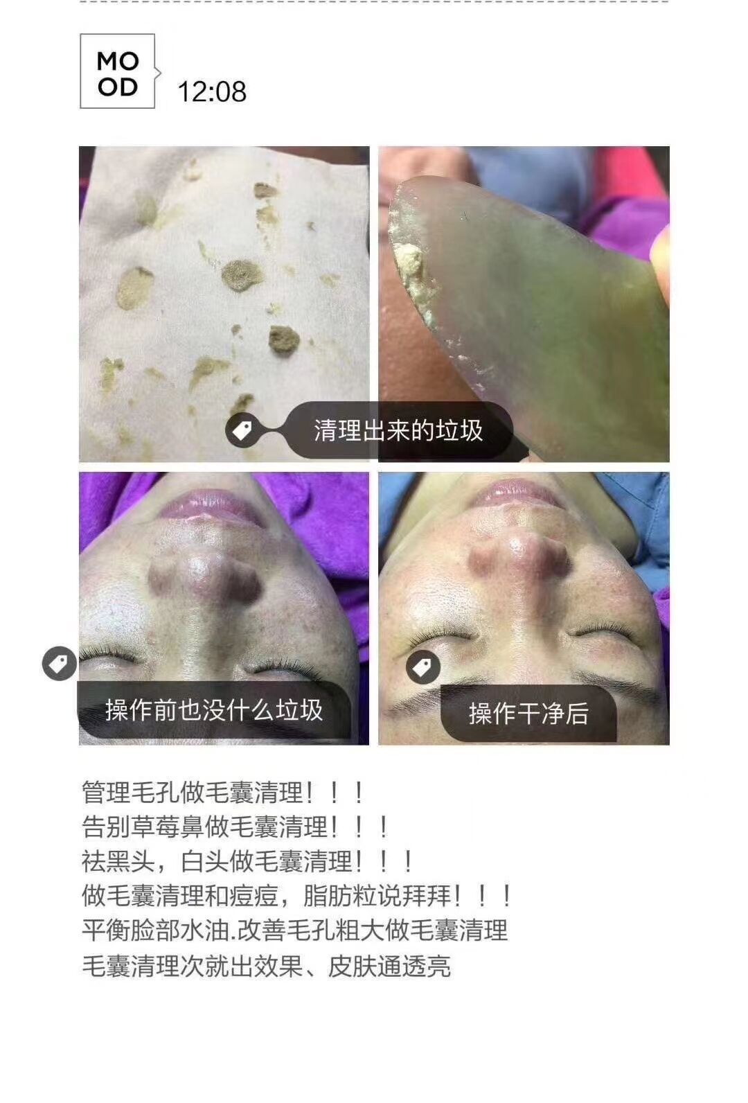 正品顶基海藻小罐洁肤霜美容院毛囊清洁术面部产品去黑头角质粉刺