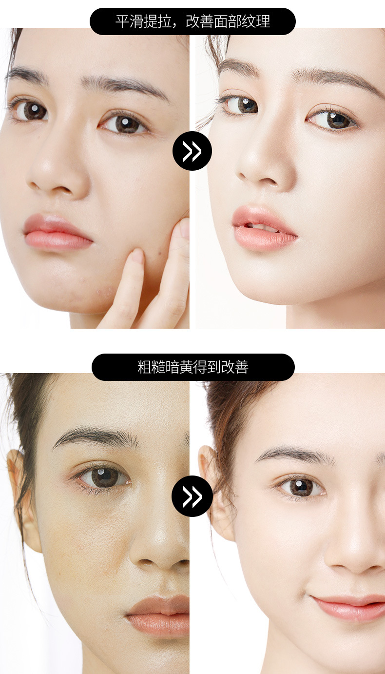 美容院面部抗皱套盒微雕鱼子酱驻颜提升紧致抗衰脸部护肤品套盒