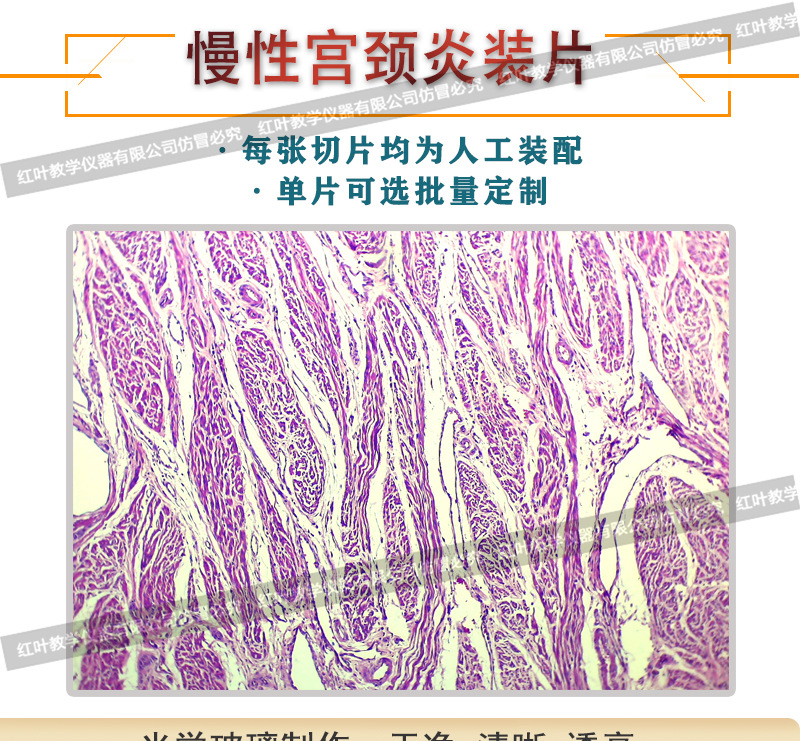 慢性宫颈炎生物切片人体病理切片显微镜配套生物切片