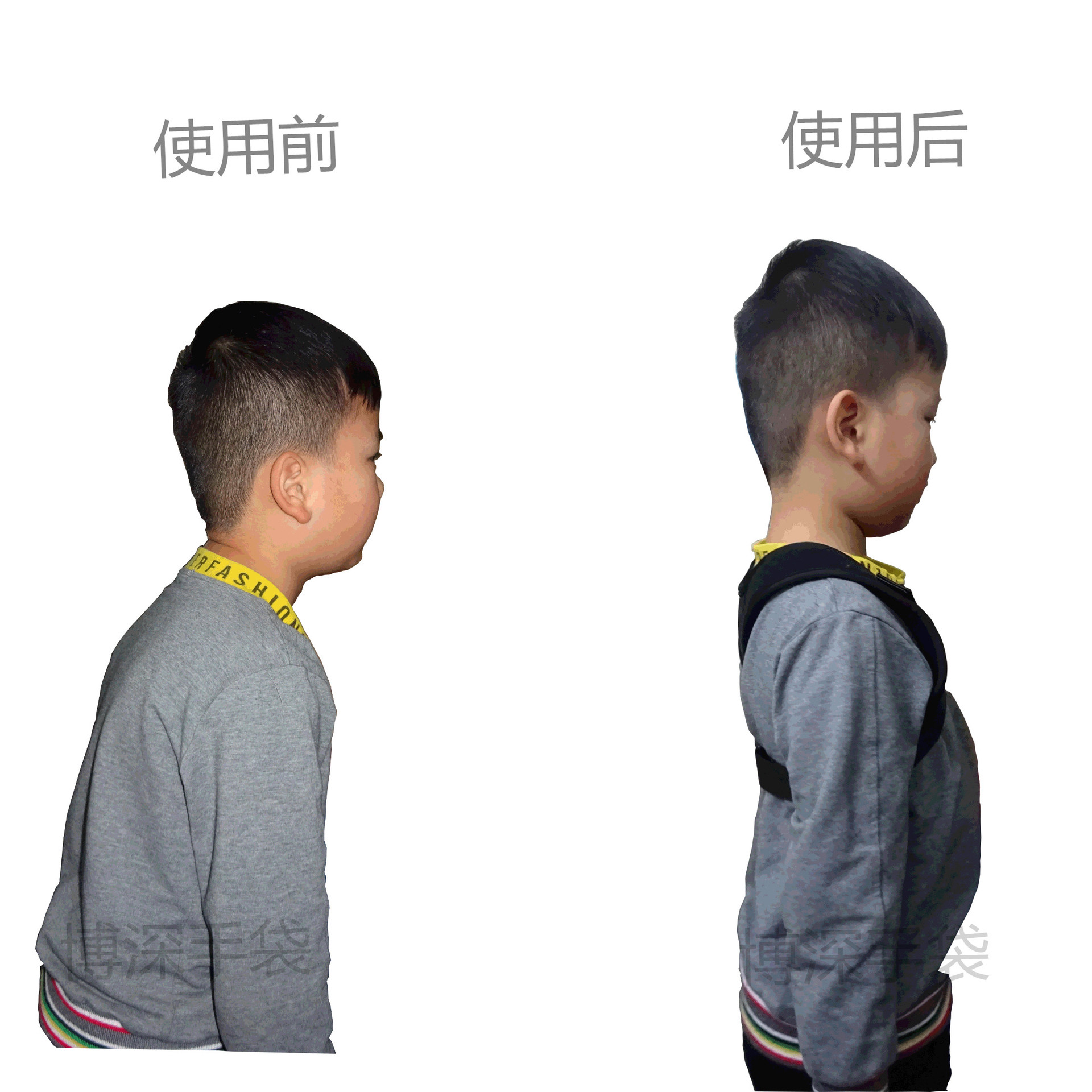 现货供应防驼背矫正带透气背部姿势矫正带隐形驼背坐姿站姿矫正器