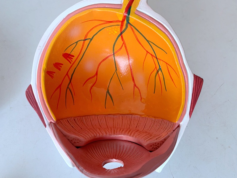 人体眼球模型眼球白内障眼疾病瞳孔眼球体眼珠精体医学教具