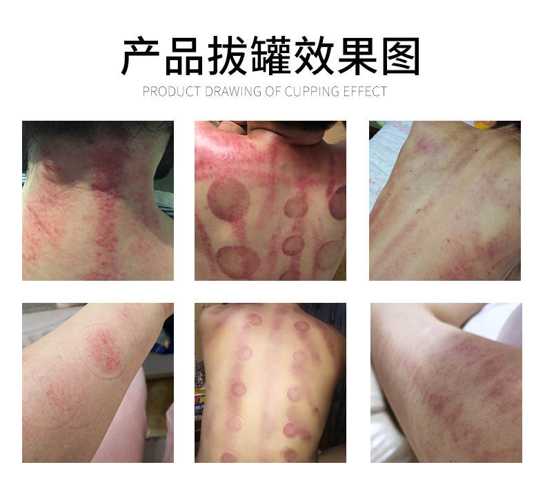 电动拔罐刮痧仪器dds生物疗经络刷疏通塑形仪器美容院厂家