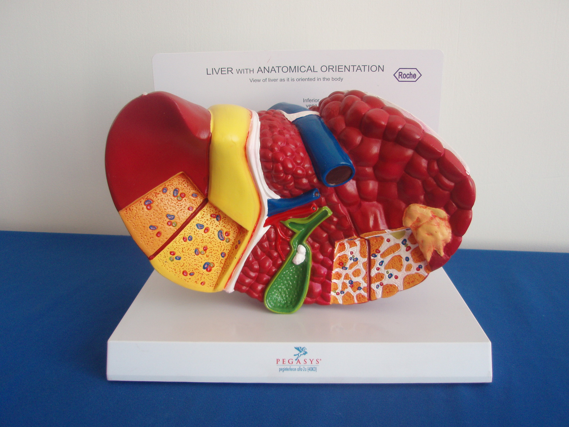 人体肝解剖模型肝分色模型肝病理模型人体模型医学教具内脏