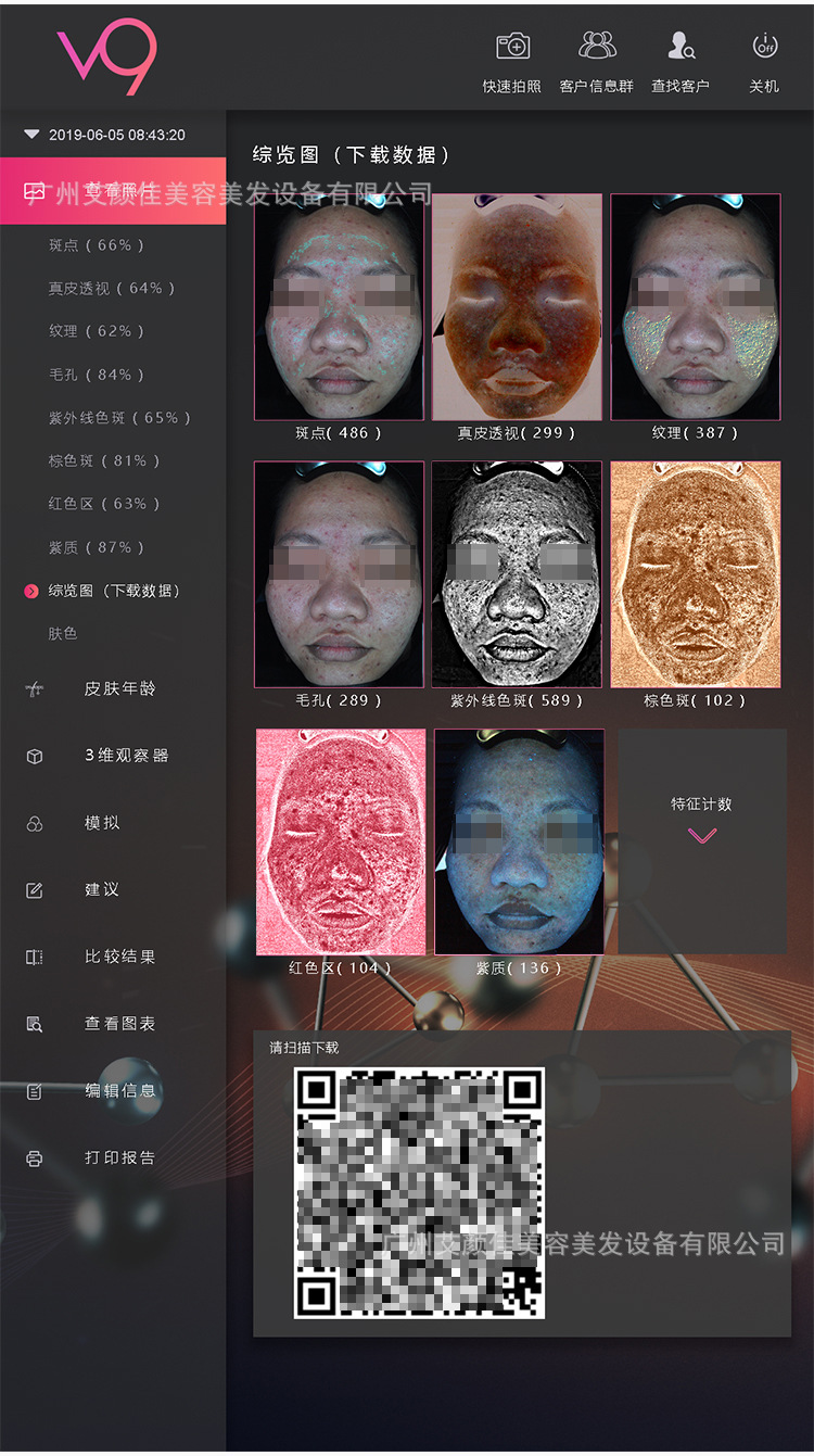 魔镜皮肤测试仪 五光谱皮肤检测 智能刷脸仪 皮肤分析ayj-v9s