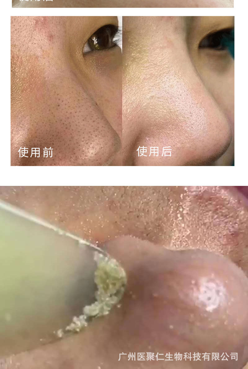 毛囊净化霜 清洁疏通毛孔去黑头粉刺洗卸二合一去黑头补水净化霜-阿里