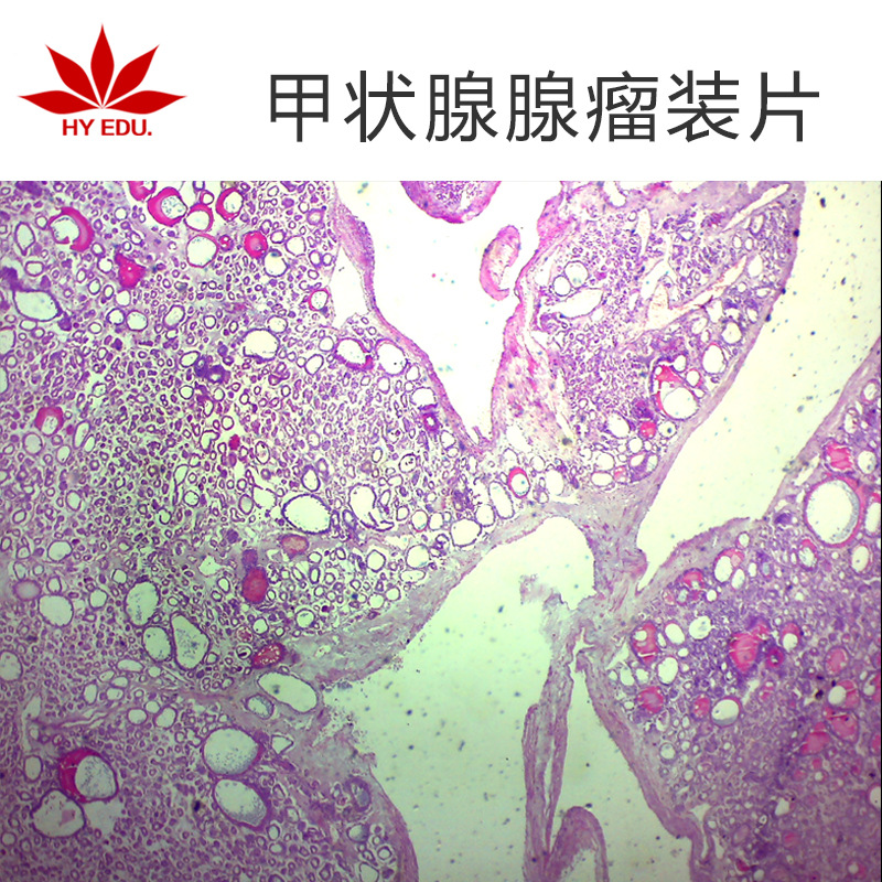 甲状腺腺瘤切片生物实验切片植物切片显微镜生物玻片