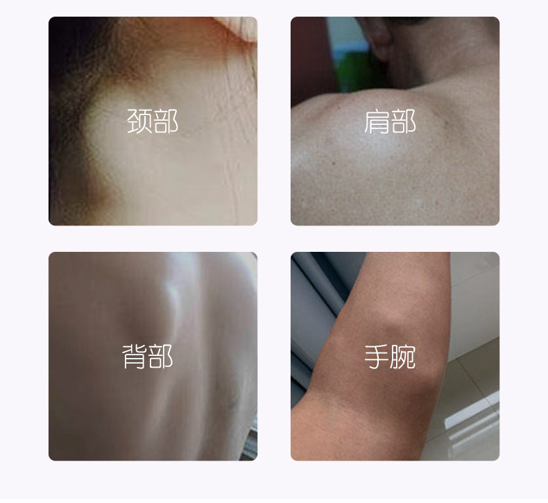 脂肪瘤膏脂肪瘤膏贴脂肪包块液全身发多单性脂肪贴消瘤膏贴代发