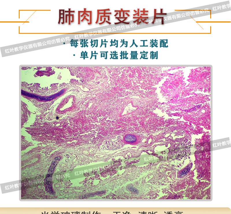 肺肉质变大生物切片人体病理切片显微镜配套生物切片