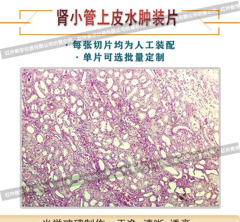 肾小管上皮水肿生物切片人体病理切片显微镜配套生物切片