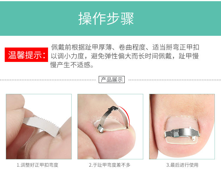 正甲扣正甲贴甲沟嵌甲矫正器脚趾甲卷亮甲专用刀嵌灰指甲套装