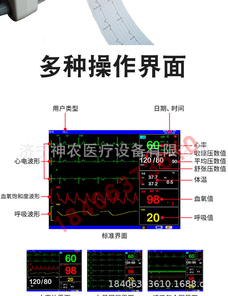 心电监护仪怎么看图解图片