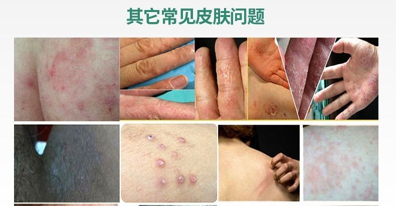 您:请正确认识化妆品功效,化妆品不能替代药品,不能治疗皮肤病等疾病