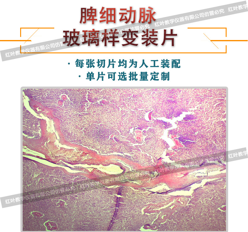 脾细动脉玻璃样变生物切片人体病理切片显微镜配套生物切片