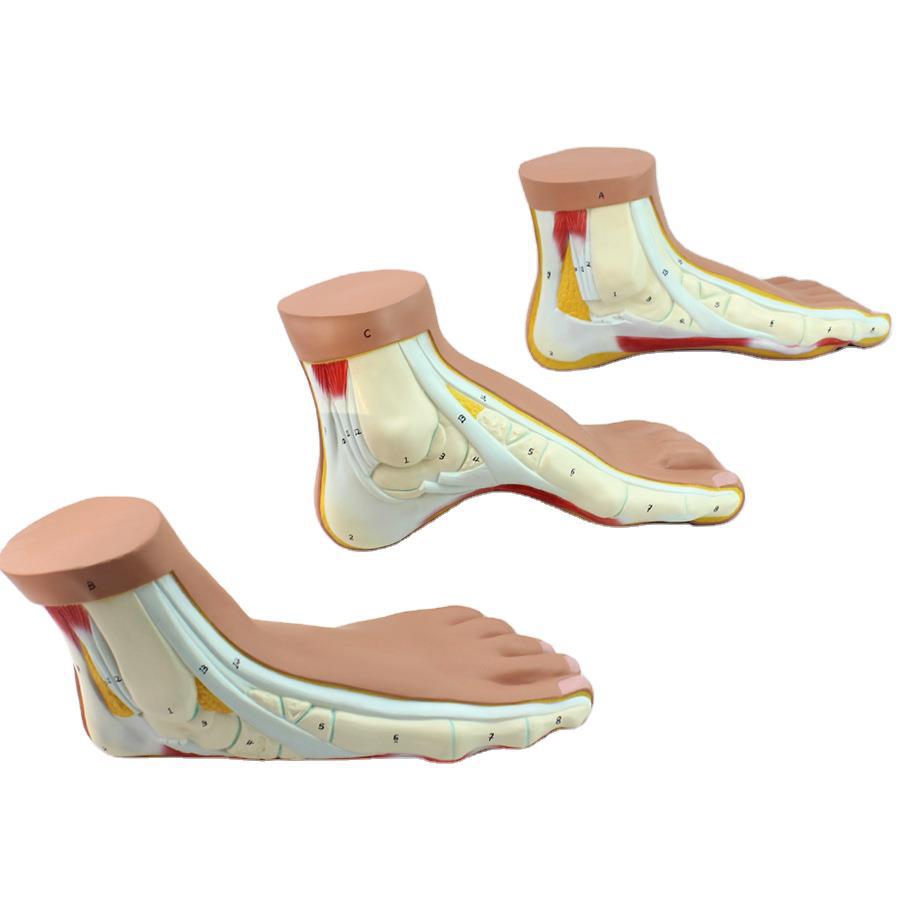enovo正常足扁平足弓形足高弓足模型脚关节骨骼模型