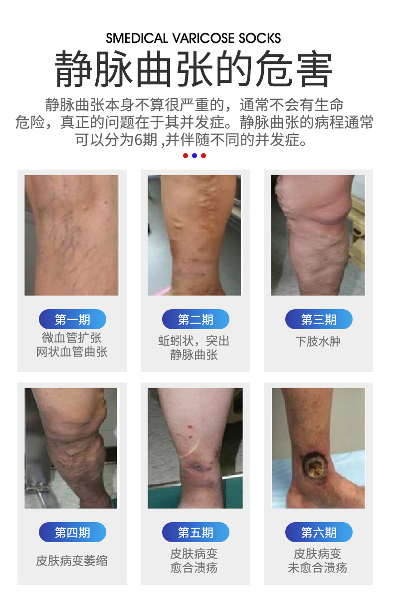 亚马逊医用静脉曲张袜弹力一二级压力护小腿袜瘦小腿套压缩袜美腿