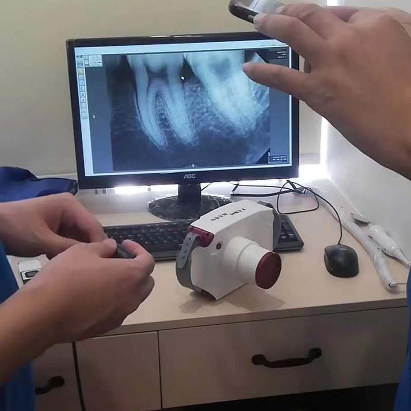 牙科口腔移动高频便携手提式x光机x-ray拍牙片机x射线机
