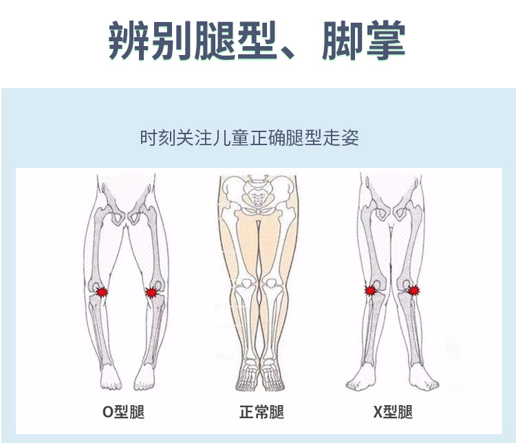 o型腿矫正鞋垫外翻足内翻x型小腿xo内外八字纠正器ox腿型儿童