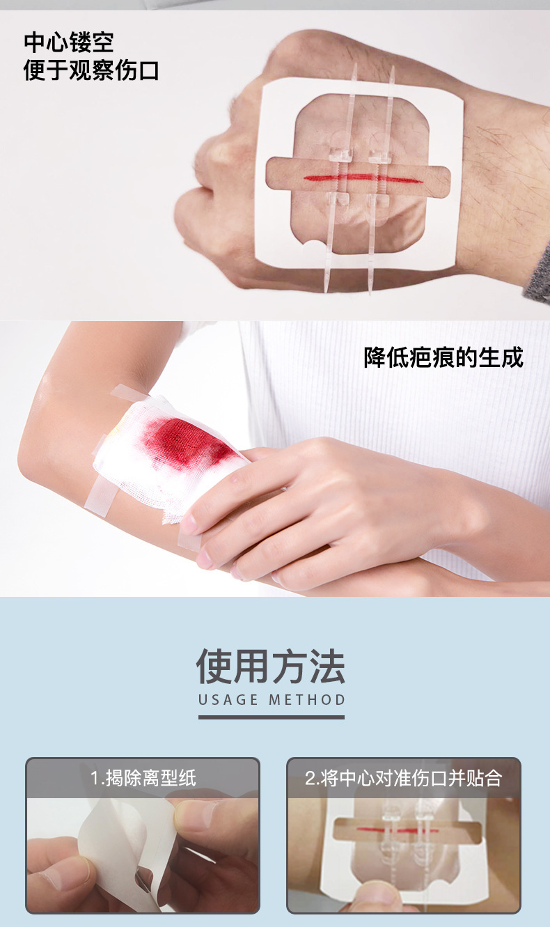 伤口缝合贴减张器拉链式拉合减张贴胶带拉链式创贴拉链式创