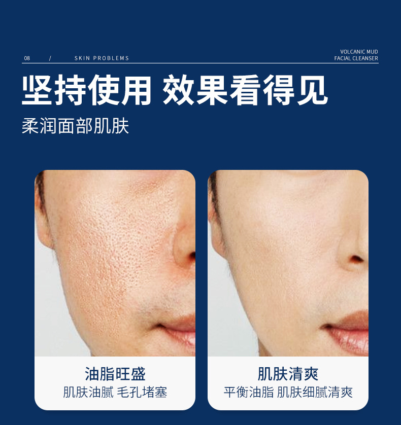 栢酷男士火山岩清爽去痘洗面奶500ml 深度清洁泡沫洁面补水保湿