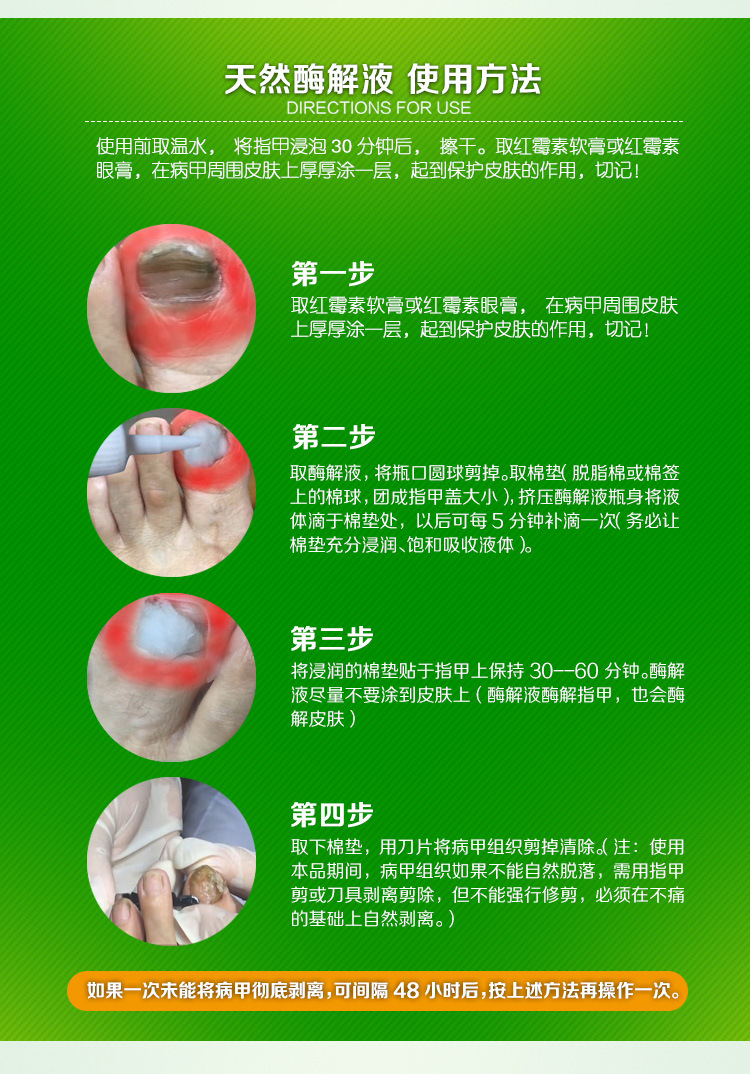 七叶足天然酶解液灰指甲液脱甲膏 亮脱甲软精油去灰指甲液批发oem