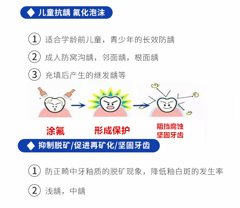 牙科 万林氟化泡沫 35克送100付牙托 防龋氟化泡沫 儿童 成人齿科