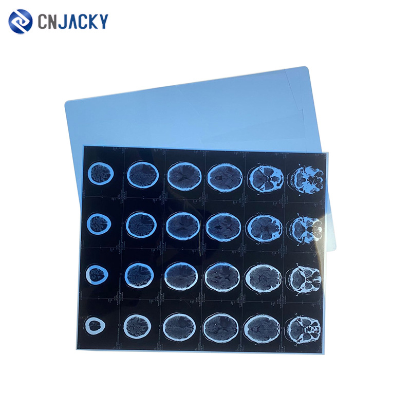 810蓝色医用胶片pvc放射科胶片a4彩超ct胶片纸激光蓝基医疗胶片