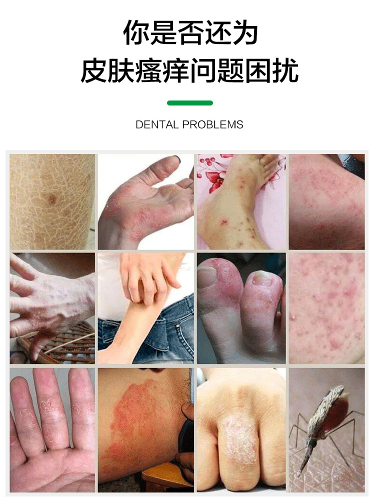 湿毒清软膏批发成人外用药膏草本乳膏涂抹型药膏可贴牌定制