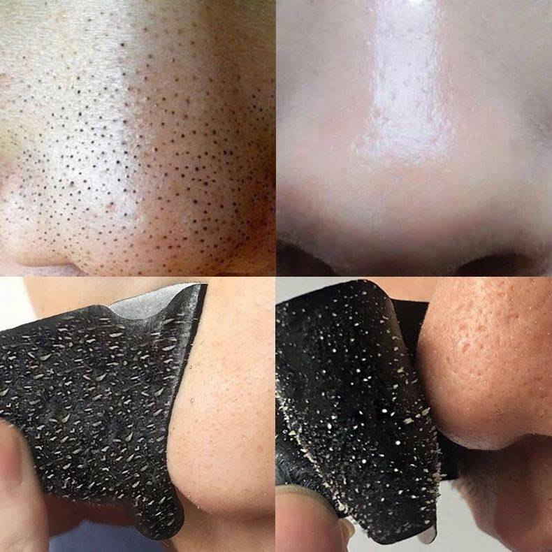 强去黑头鼻贴猪鼻贴撕拉式去黑头去粉刺鼻贴竹炭 吸黑头贴黑头贴