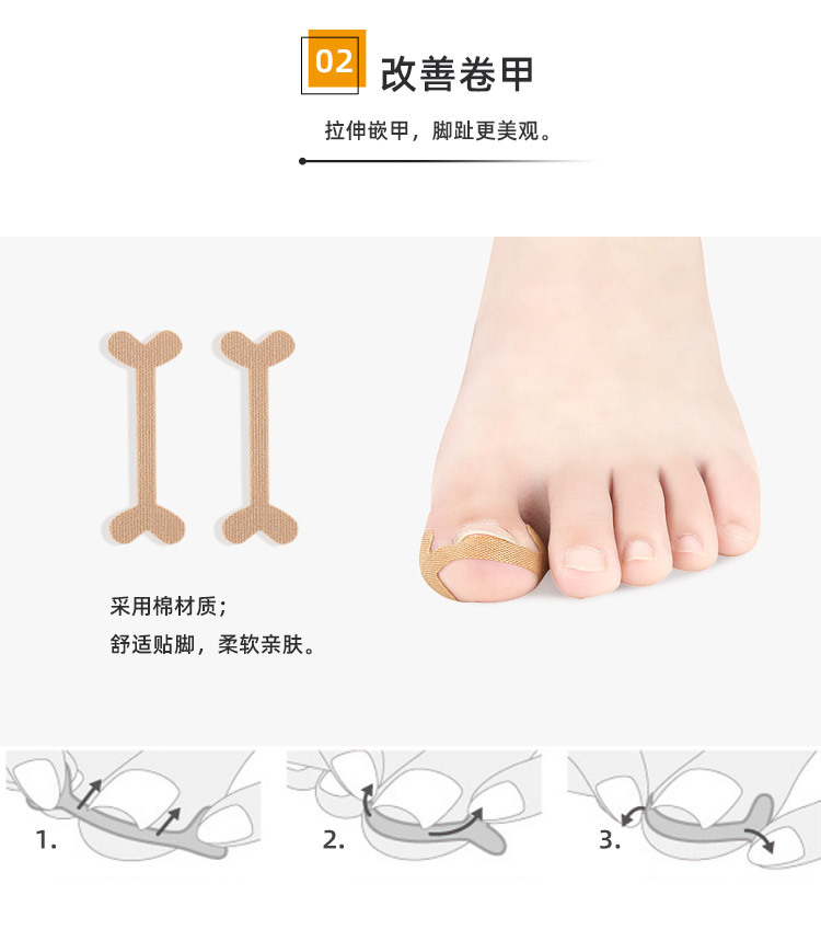 正甲贴甲沟嵌甲脚趾甲拉伸贴片矫正工具套装指甲长肉里修脚套装