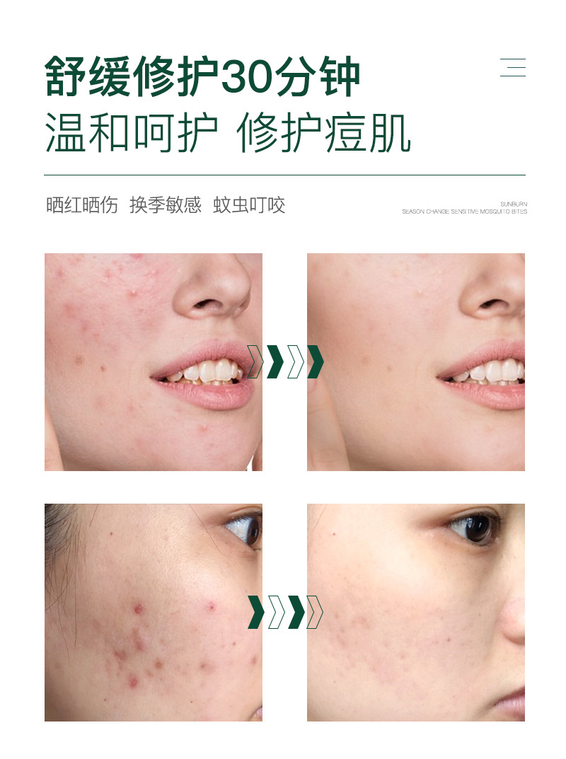 韩佳妮芦荟凝胶500ml滋润补水舒缓水油平衡控油厂家直销批发