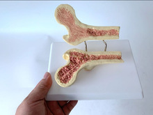 人体股骨骨质疏松模型 解剖股骨内部构造 人体骨骼 骨架 骨骸模型