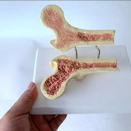 人体股骨骨质疏松模型 解剖股骨内部构造 人体骨骼 骨架 骨骸模型