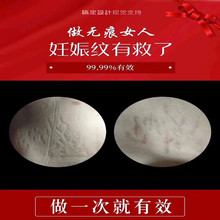 祛壬娠纹产后修复液疤痕手术淡化肥胖纹祛痘印痘坑祛真性皱皮纹