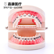 嘉康牙齿模型教学用口腔模型牙齿正畸模型带托槽正畸齿科模型