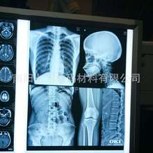 厂家批发医用CT CR DR 磁共振X光蓝色激光A3打印胶片
