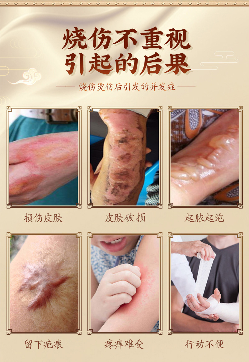 康民堂紫草烧伤膏开水烫伤膏草本烧烫伤膏急救箱包配件膏身体护理