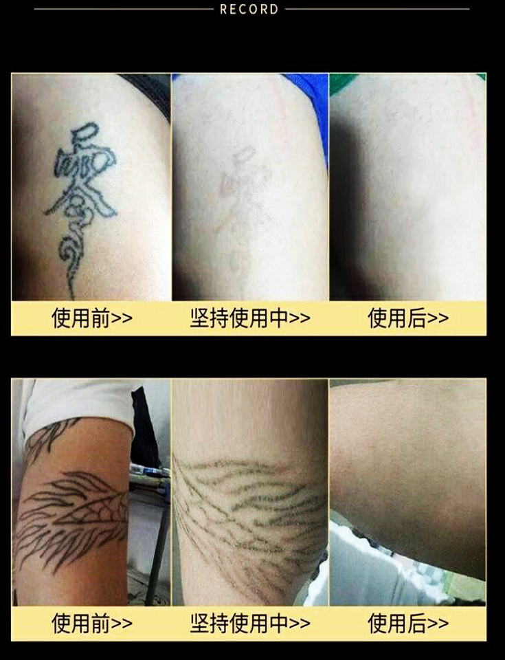 韩鹭舒纹净肤精油洗纹身药水精华液纹身无痛无疤痕洗纹身水