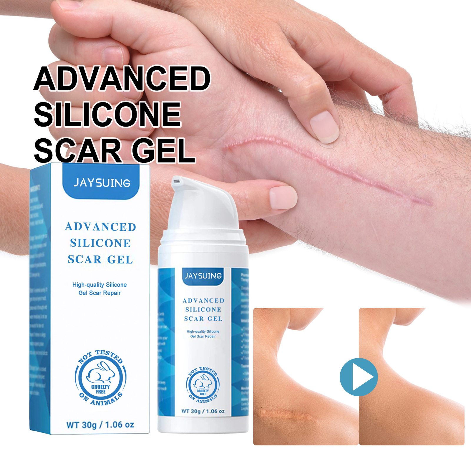 Jaysuing Scar Gel Fade Scar Pregnancy Surgery Scar Acne Marks Smooth Skin Care Gel