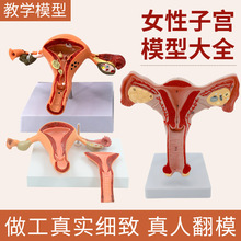 病理子宫模型 女妇产子宫结构解剖 仿真病态子宫模型示教模型