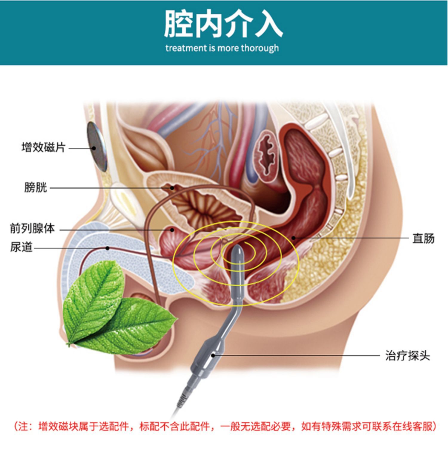 非凡前列腺炎治疗仪家用加热型前列腺治疗按摩器前列腺炎康复理疗