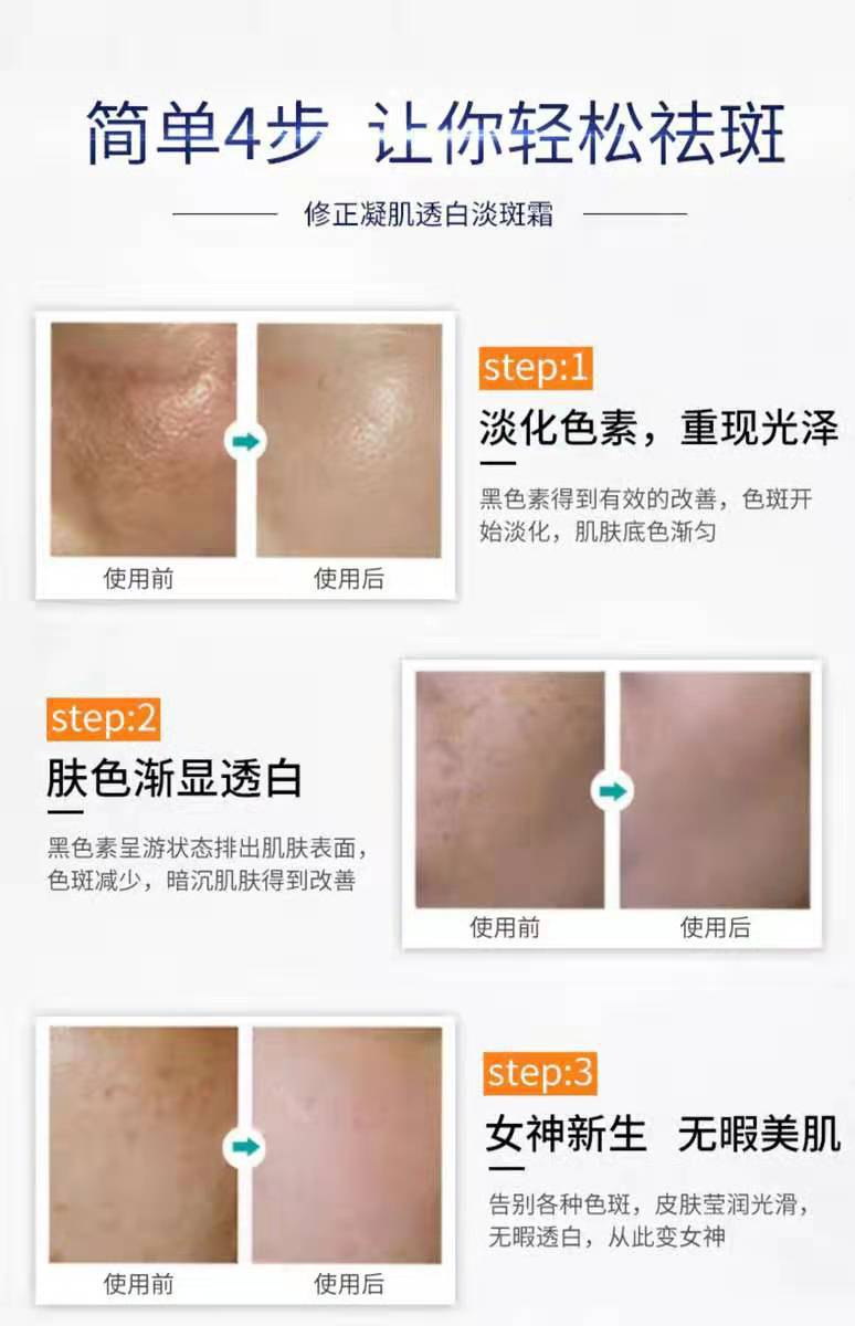 修正凝肌祛斑霜美白化妆品去斑雀斑凝肌淡斑神器去黑色素淡化色斑