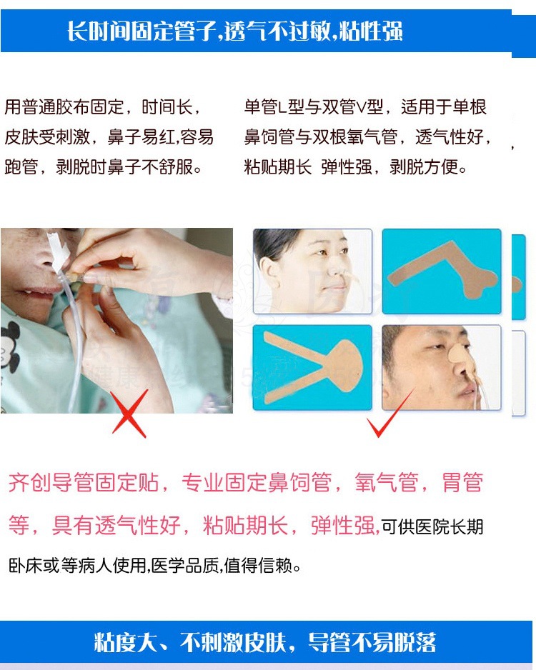 鼻胆管固定方法图片图片