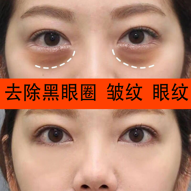 艾地苯弹力拉丝眼霜去皱紧致去眼袋淡化黑眼圈热熔霜多肽抗皱眼霜