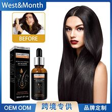 West&Month 头发护理精油 头发浓密生长修护干枯毛躁滋润秀发精华