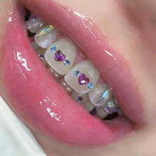 跨境欧美嘻哈盒装复古牙钻金属高品质锆石牙饰辣妹牙齿装饰品
