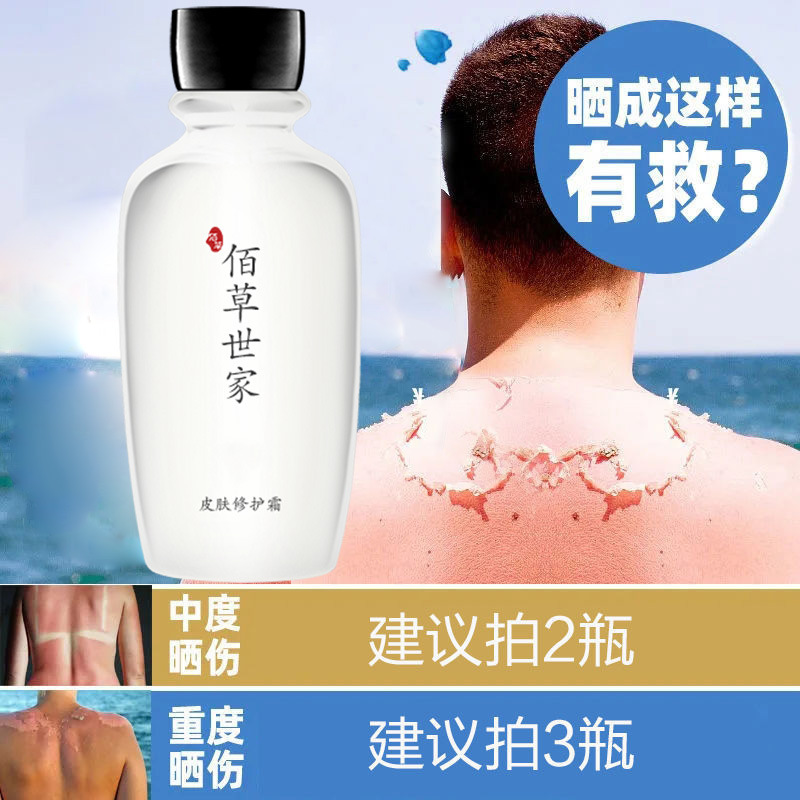 佰草世家晒后修复霜晒伤晒黑脱皮晒红肿补水保湿变白男女夏天