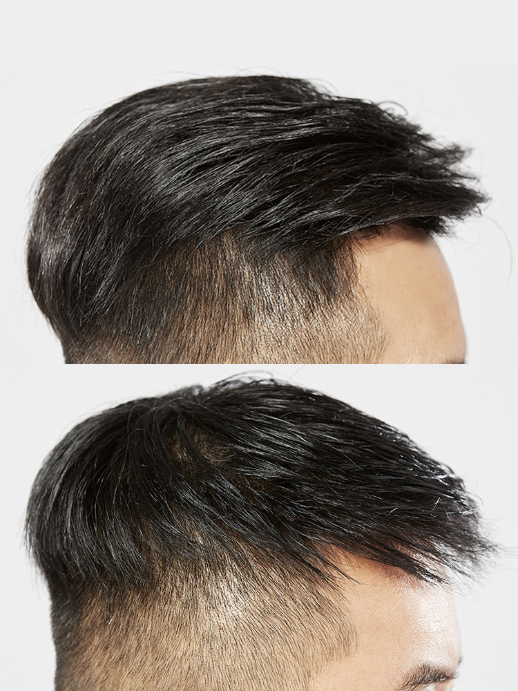 假发男帅气韩版透气假发片男式自然逼真真发头顶补发片男士假发套