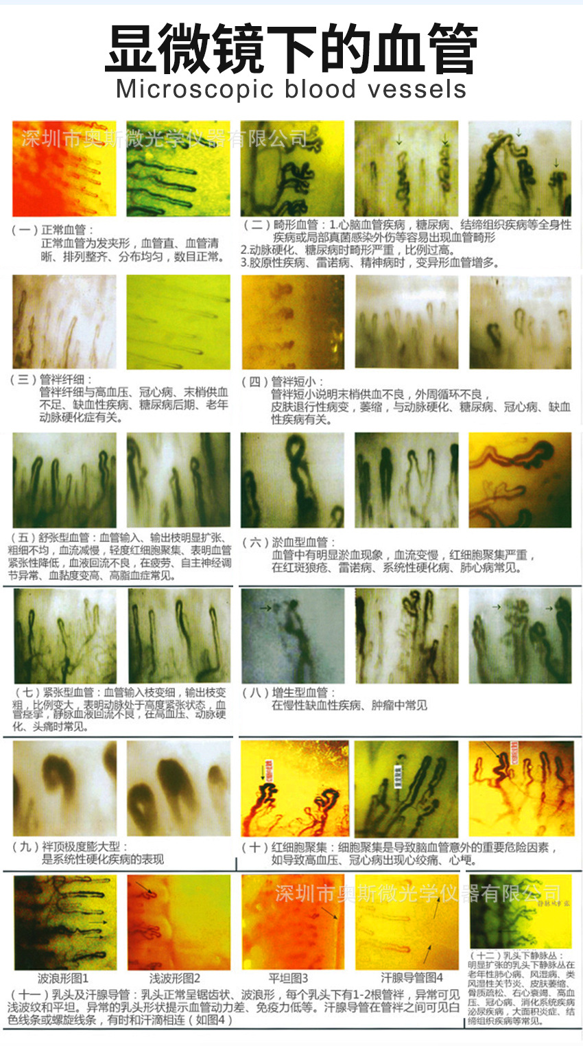 微循环检测仪一体机 视频检测 末梢血管观察仪 血液流速检查仪