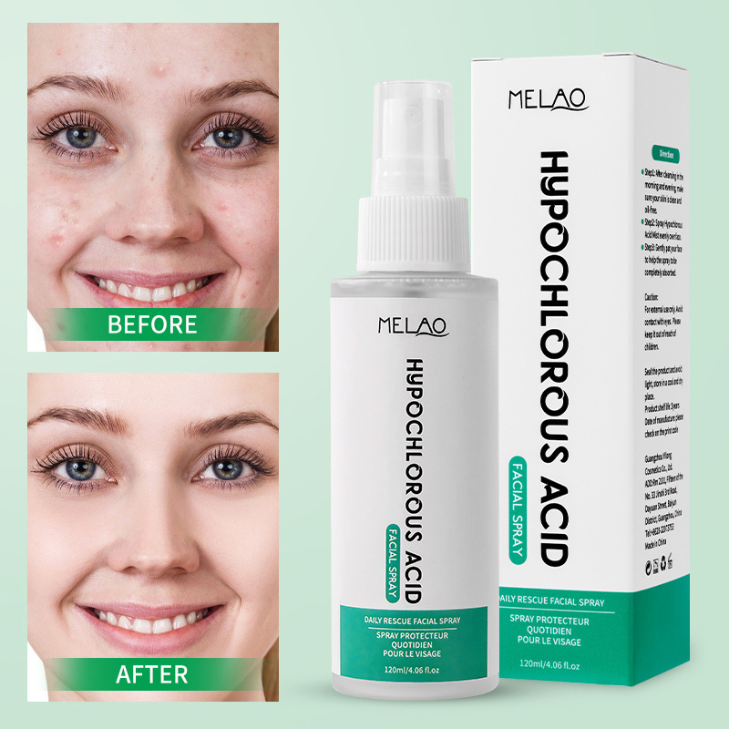 新品爽肤次氯酸皮肤喷雾hypochlorite spray爽肤水次氯酸喷雾跨境